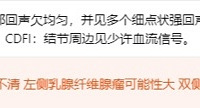 甲状腺5级,等待穿刺活检结果中