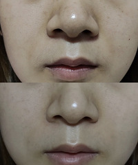 �����۷�ǰ��Աȣ�ԭ�������ͷ�������˾�