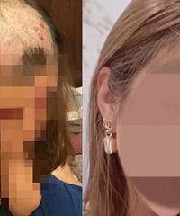 丈夫怀疑妻子出轨,暴打老婆剃光头