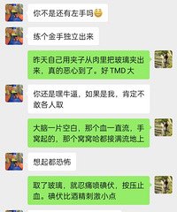 �������ܴ��ͣ�һ�鲣����ȫǶ������Ҿ�Ȼ������ǯ�Ӽг�����