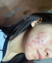 ��Ƥ���޲���������һ��ʲô���飬����Ƥ����⻬������