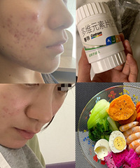 从皮肤很差到慢慢变好,我用了这些方法