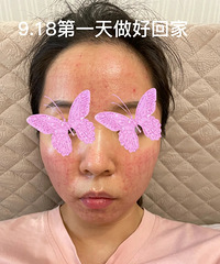 ��������λƽ�΢���5��ָ��ڷ���