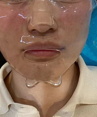 �������ˮ���룬Ƥ����Ľ���������