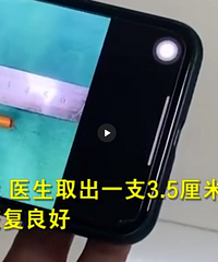 2��Ůͯˤ�����Ӵӱ�ǻ����ۿ�����ĸ���������