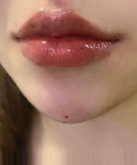 �Ҵ��˲�����ᴽ���������°�