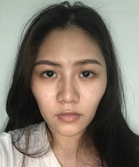 ��������֬����ȫ���沿��䣬�ø��ݵ�����������