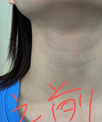 ������ ��쾱�㻹������������