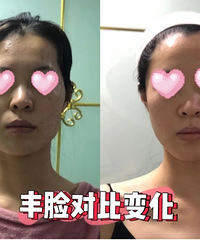 ���ζ�û�뵽̫��Ѩ�������б仯��