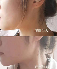 ҽ�� | ���˴��������һЩ����ͽ� ��