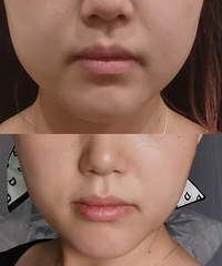 ����������飬����100��λ