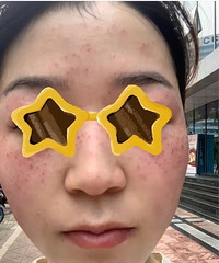 ���м������ߣ��ҵ�Ƥ�����̫�������˰�