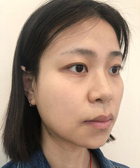 Ƥ���������죬�Ͻ�ȥ��ҽ�����ҿ�����ô����