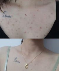 ǰ�غͺ󱳳��ö������ڱ��κ���