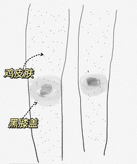 ��֪����ôȥ��ϥ�Ǻͼ�Ƥ�ˣ�