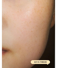 �����۷���ҿ��Աȣ���Ч����