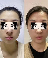 ע���������ע��Ĳ�λ������?