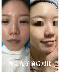 ��һ����������۷��������Ч��