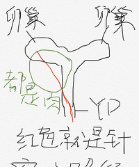 不打麻药取卵,你猜是什么感jio??