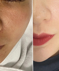 ���ƽ�΢��5��������������ʵͼƬ��