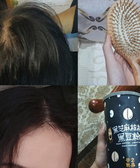 分享用过的防脱好方法,现在脑壳不秃了