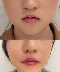 �ﶬ���̫�ʺϴ��ུ���