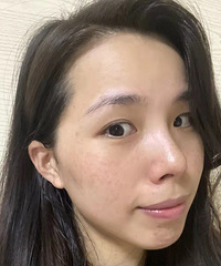 Ƥ�������޸������������ֹ���ں���Ҫ��