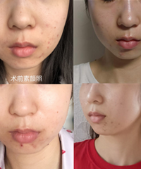想要美白提亮抗衰老,教你怎么选择仪器