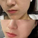 ���Ǻ�Ƥ�����۰���