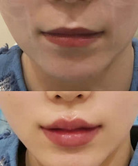 ������ᴽ����������������ڵ�ҽ��֮һ