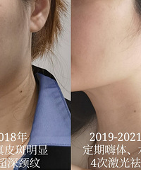 �����͵�ȧ�ǰߣ�3������Ƴ��װݰ�|������Ŀ+�ȹ��Ŀӷ���