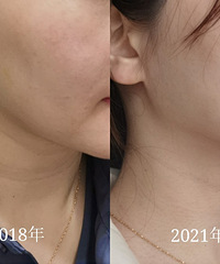 �����͵�ȧ�ǰߣ�3������Ƴ��װݰ�|������Ŀ+�ȹ��Ŀӷ���