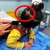 ͷ���������Կ�ˤ��Ѫ