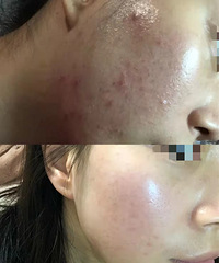 Iphoneǰ�����˾���¼ح�����Ľ����ǿ�����