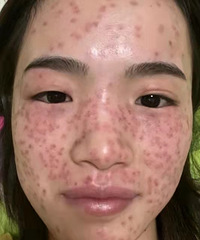 ����ȸ�ߵ��Ҳ�Ӳ���ˣ�����ȥҽԺ���