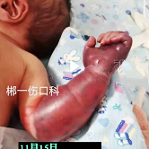 ����������ֱ۷���