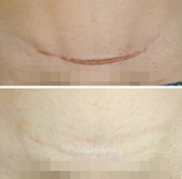 �ʸ����İ̺���ʧ��