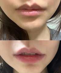 ����ղ�����ᴽ ������һ��Ч��