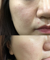 ֱ�����ճ��ر���ˮ�Ᵽ����ë�����ۿɼ���С�ˣ�Ƥ����ϸ��