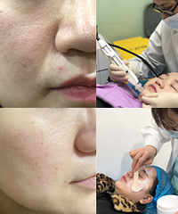 日常必备水光保养!毛孔肉眼可见变小了