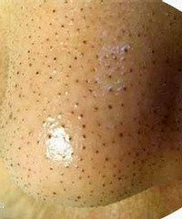 ��ͷԽ��Խ����ô�죿������������������