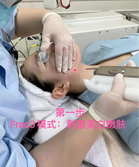 ҽ����������Ȼ��fotona4D�����ˣ�����ʲô������