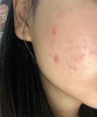 ʫ���ݵ����+270���ˢ̫���ˣ�覴�Ƥ�Ľ���һ��Ҫ���ԣ�