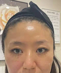 �����ײ���˳����ڣ�Ч���������꼪