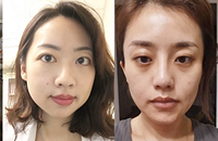 来看论坛网友2021年,为抗衰做的努力