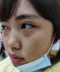 ȥ�������۷�����������ҽ��˵��������Ҫ��������ⲻ�����