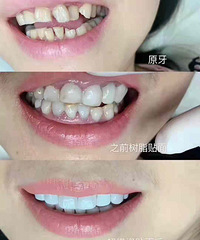 ���Ĵ�����ĥ����������֪