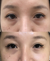 �����Ӵ�̽����һ��Ƥ�����������ܸ��ƴ��۴��������ּ�