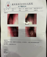8个月内到院6次对比3家医院,终于消灭腺样体