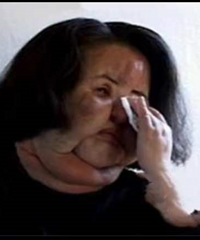 ������񫡱���۾����������ɵ���ȣ�����ע��ʳ���ͣ����۲�ʹ